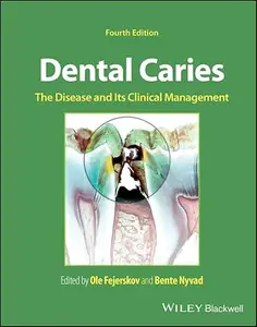 Dental Caries The Disease and its Clinical Management, 4th Edition