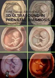 3D Ultrasound in Prenatal Diagnosis A Practical Approach, 2nd Edition