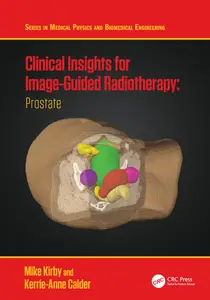 Clinical Insights for Image-Guided Radiotherapy Prostate