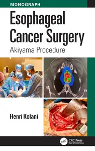 Esophageal Cancer Surgery Akiyama Procedure