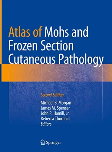 Atlas of Mohs and Frozen Section Cutaneous Pathology, Second Edition