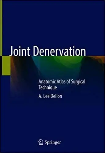 Joint Denervation An Atlas of Surgical Techniques