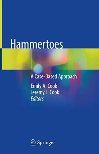 Hammertoes A Case-Based Approach