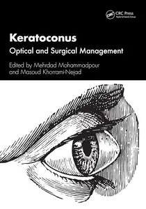 Keratoconus Optical and Surgical Management