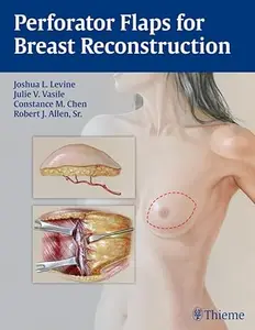 Perforator Flaps for Breast Reconstruction