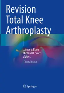 Revision Total Knee Arthroplasty (3rd Edition)