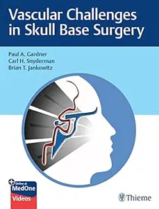 Vascular Challenges in Skull Base Surgery