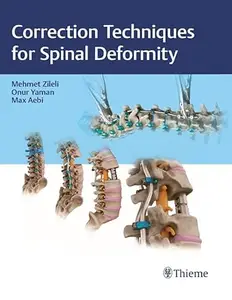 Correction Techniques for Spinal Deformity