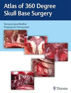 Atlas of 360 Degree Skull Base Surgery