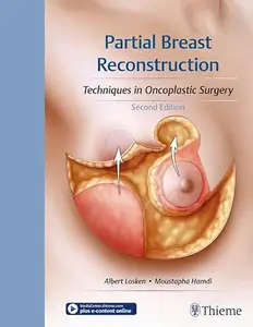 Partial Breast Reconstruction (2nd Edition)