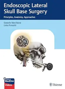 Endoscopic Lateral Skull Base Surgery