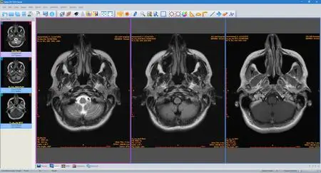 Sante DICOM Viewer Pro 14.0.12