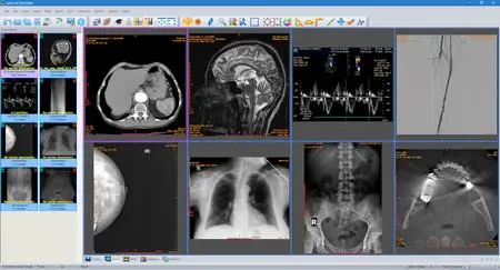 Sante DICOM Editor 10.0.12