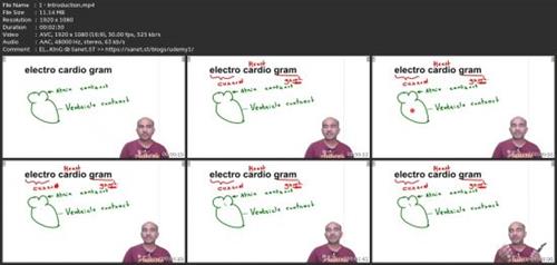 Ecg - Draw 12 Leads In 5  Minutes 362c957c2ef893d285b2687195773933