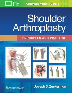 Shoulder Arthroplasty Principles and Practice