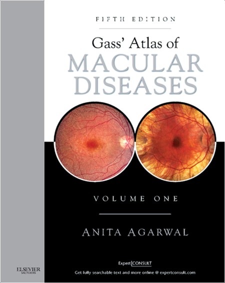 Agarwal A  Gass' Atlas of Macular Diseases Vol 1-2  5ed 2012