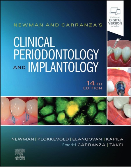 Newman P  Newman and Carranza's Clinical Periodontology   Implantology 14ed 2023