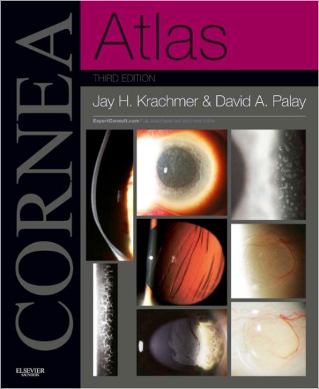 Krachmer J , Palay D  Cornea Atlas 3ed 2013