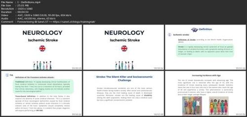 Stroke: Modern Diagnostics And  Treatment 3df19eabc8c22eb3590ff2850a36fc60