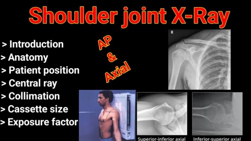 Radiology X-Ray of shoulder joint