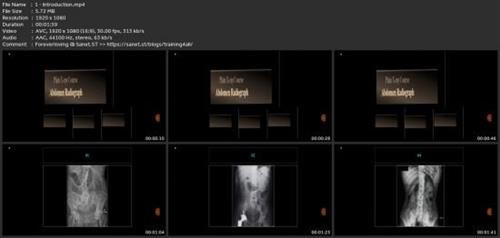 How To Read Abdominal X-Ray From  Zero To  Hero Cc648295c4c2a35a363172bafb5e9db6