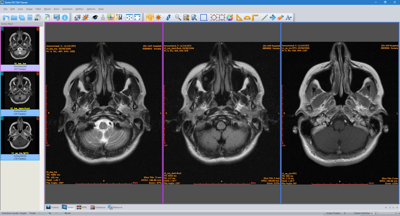 Sante DICOM Viewer Pro 14.0.15