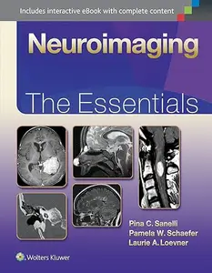 Neuroimaging The Essentials