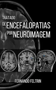 Tratado de Encefalopatias por Neuroimagem Fernando Belomé Feltrin (Portuguese Edition)