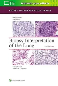 Biopsy Interpretation of the Lung  Ed 2