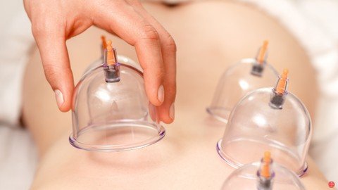 Udemy – Certified Course – Practical Cupping Therapy