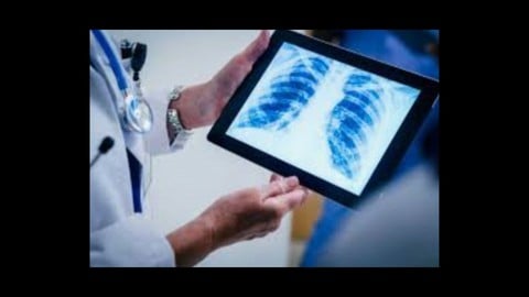 Udemy – Chest X–Ray Course From Zero To Hero