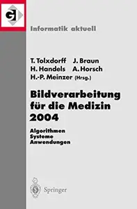 Bildverarbeitung für die Medizin 2004 Algorithmen – Systeme – Anwendungen