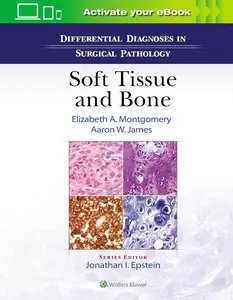 Differential Diagnoses in Surgical Pathology Soft Tissue and Bone