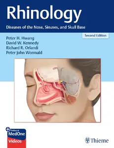 Rhinology Diseases of the Nose, Sinuses, and Skull Base, 2nd Edition