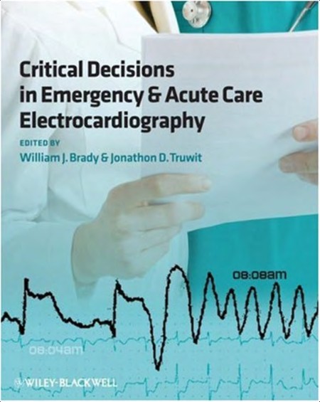[medical] Critical Decisions in Emergency and Acute Care by William J  Brady PDF