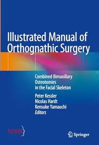 Illustrated Manual of Orthognathic Surgery