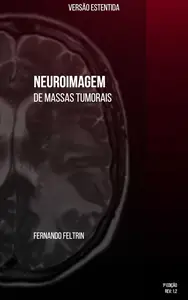 Neuroimagem de Massas Tumorais Versão Estendida (Portuguese Edition)