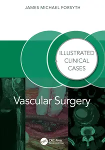 Vascular Surgery Illustrated Clinical Cases