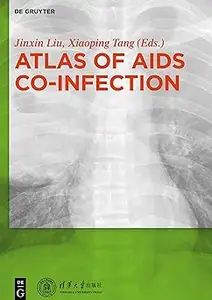 Atlas of AIDS Co–infection