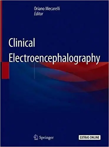 Clinical Electroencephalography (PDF)