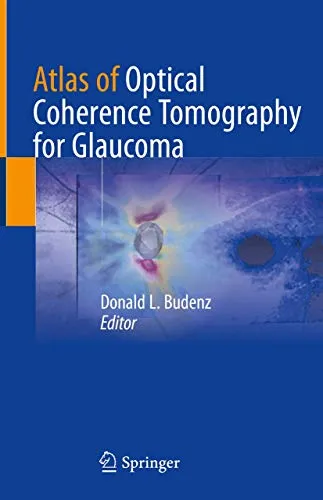 Atlas of Optical Coherence Tomography for Glaucoma