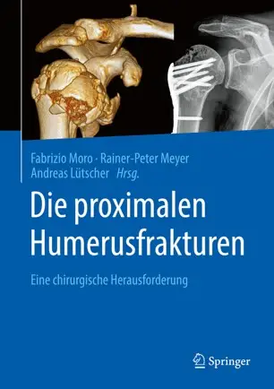 Die proximalen Humerusfrakturen Eine chirurgische Herausforderung