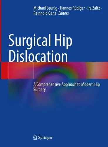 Surgical Hip Dislocation A Comprehensive Approach to Modern Hip Surgery