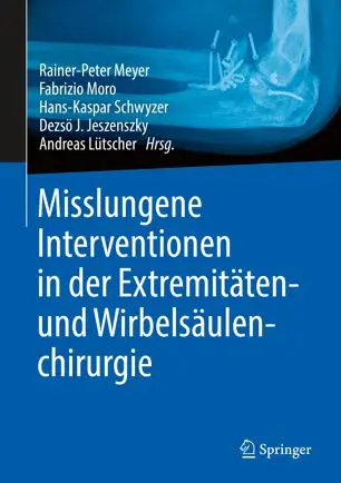 Misslungene Interventionen in der Extremitäten– und Wirbelsäulenchirurgie