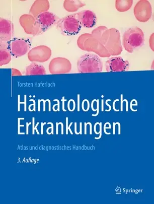 Hämatologische Erkrankungen Atlas und diagnostisches Handbuch