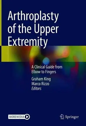 Arthroplasty of the Upper Extremity A Clinical Guide from Elbow to Fingers