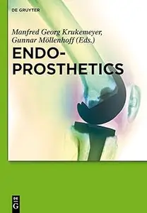 Endoprosthetics