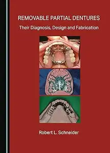 Removable Partial Dentures Their Diagnosis, Design and Fabrication