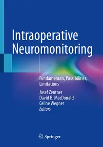 Intraoperative Neuromonitoring Fundamentals, Possibilities, Limitations