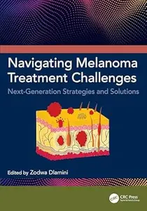 Navigating Melanoma Treatment Challenges